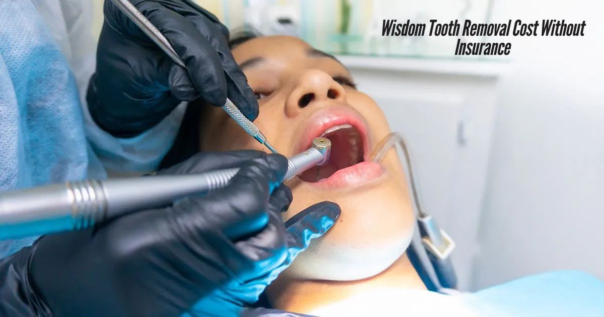 Wisdom-Tooth-Removal-Cost-Without-Insurance